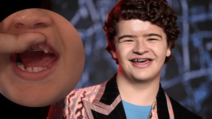 Gaten Matarazzo Krankheit